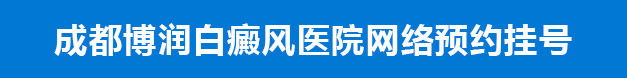 ԤԼ